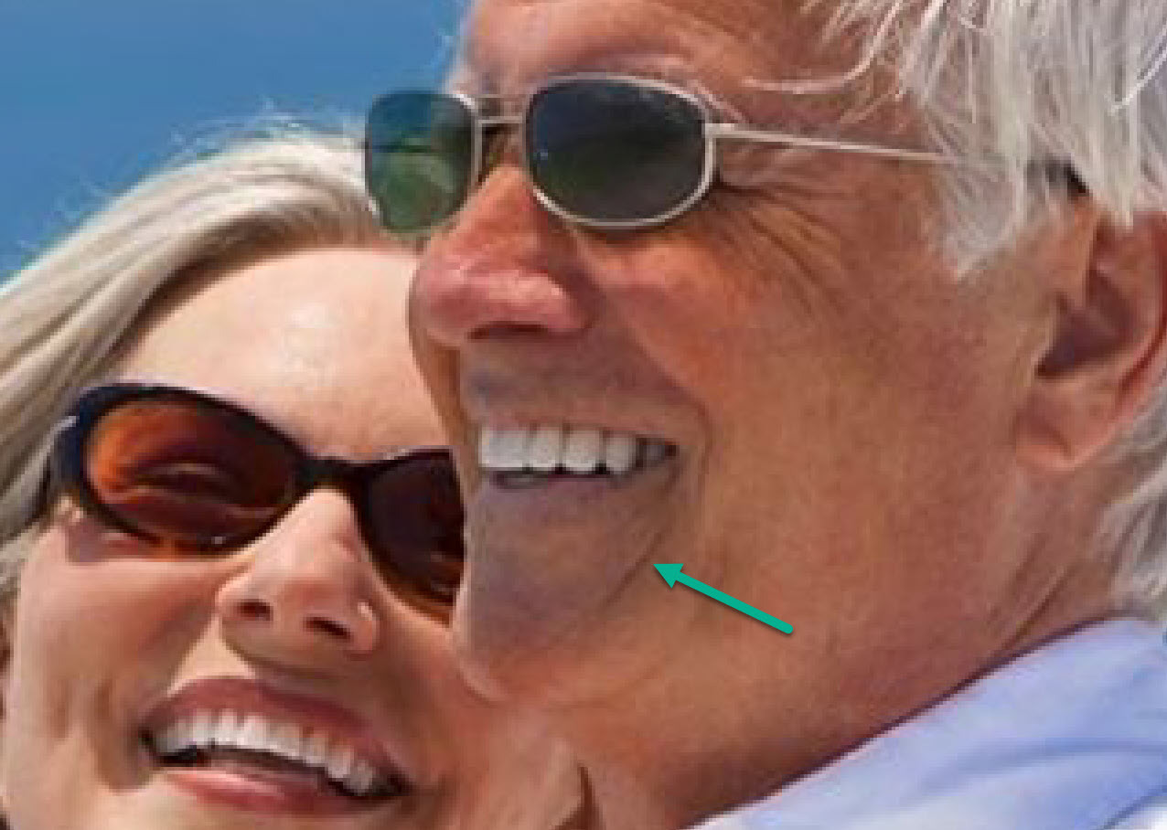 Remove spots and small distractions